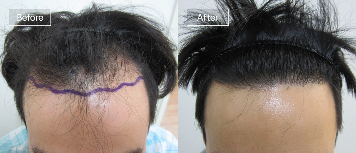 /filedata/md_board/20260102174314_IbGQVWZy_sub1_slide6.jpg 전후사진