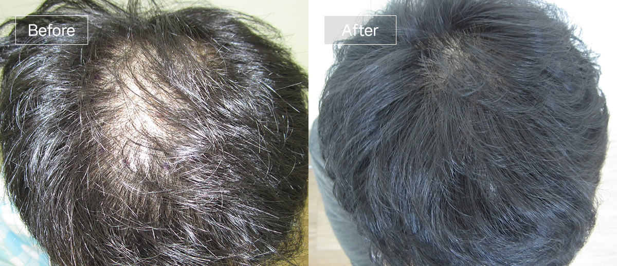 /filedata/md_board/20260102174325_x6Huv3WN_sub1_slide5.jpg 전후사진