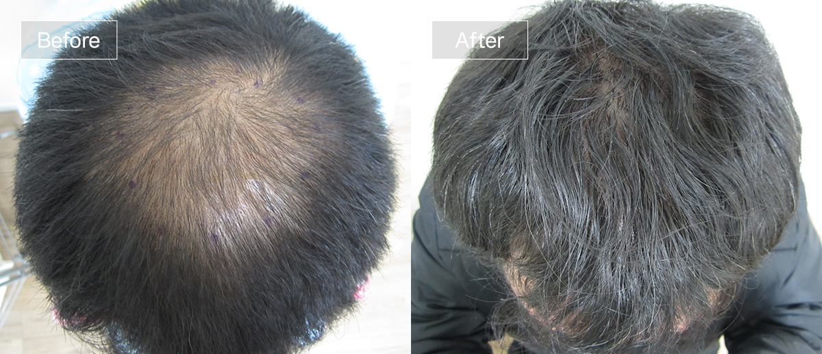 /filedata/md_board/20260102174352_kMFKLXGa_sub1_slide3.jpg 전후사진