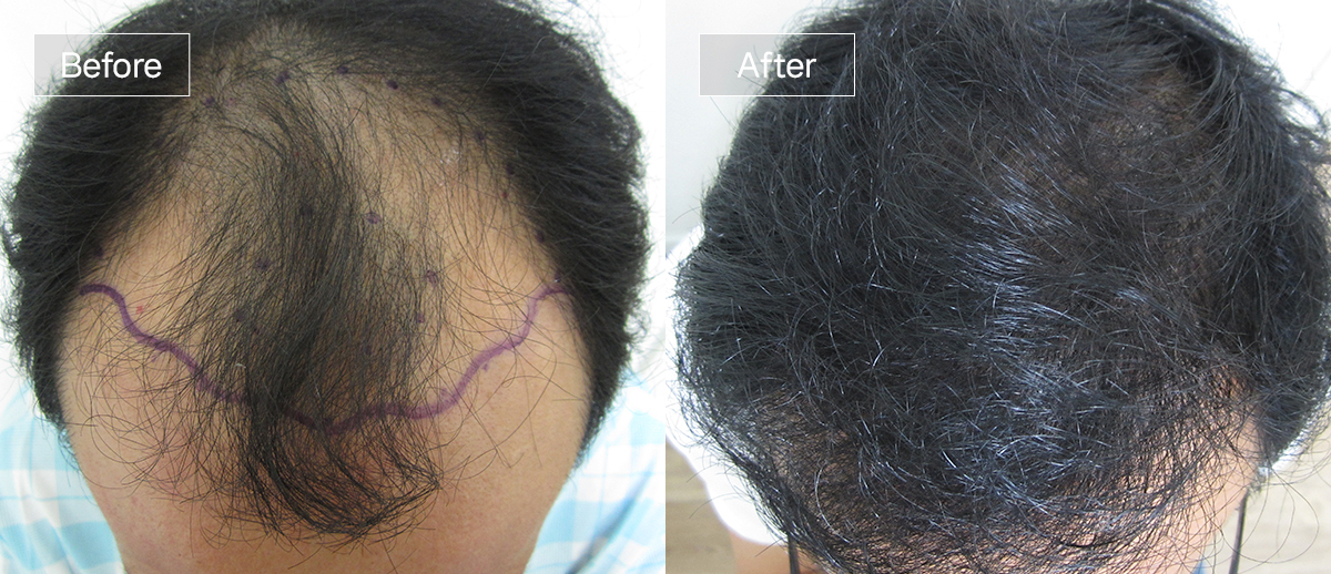 /filedata/md_board/20260102174409_A9bUjfXv_sub1_slide1.jpg 전후사진