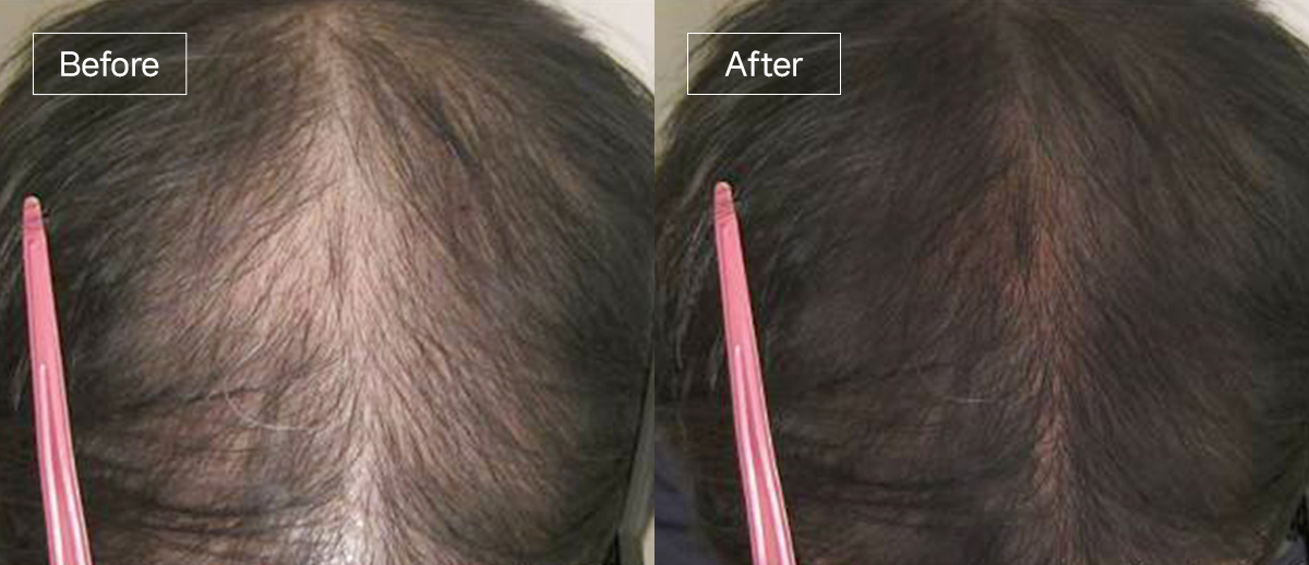 /filedata/md_board/20260102174540_UdoGibME_slide2.jpg 전후사진