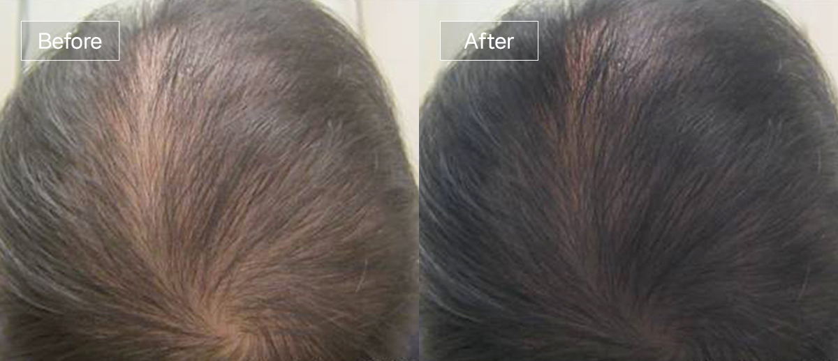 /filedata/md_board/20260102174557_5rLtv7BY_slide4.jpg 전후사진