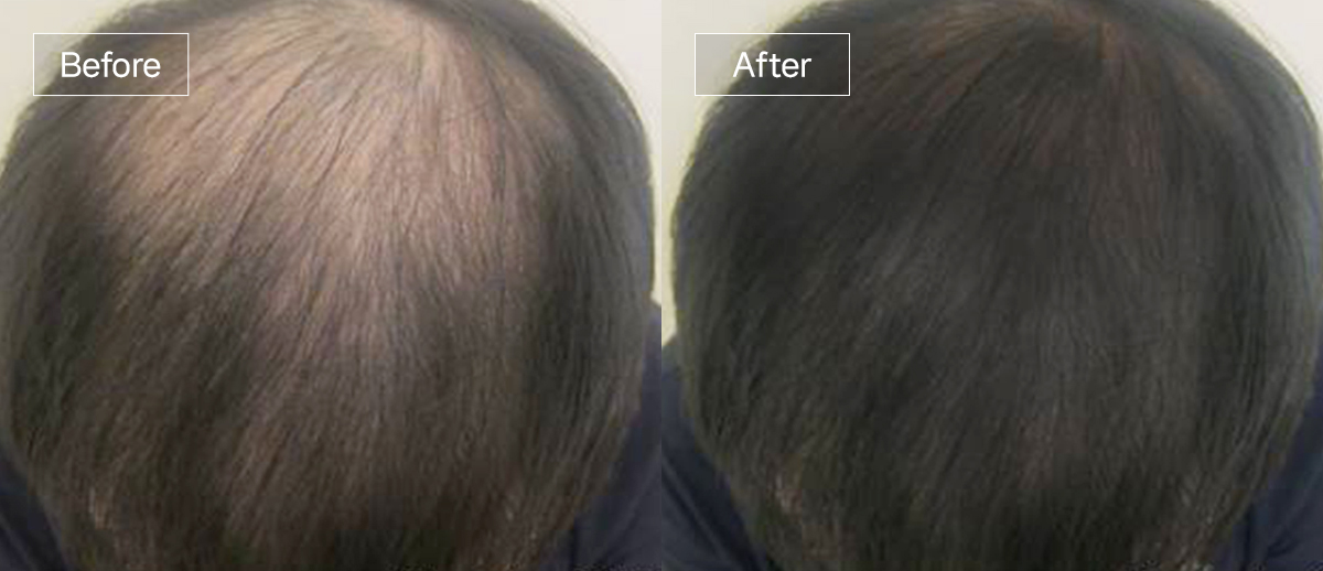 /filedata/md_board/20260102174656_f7FWbkev_slide7.jpg 전후사진