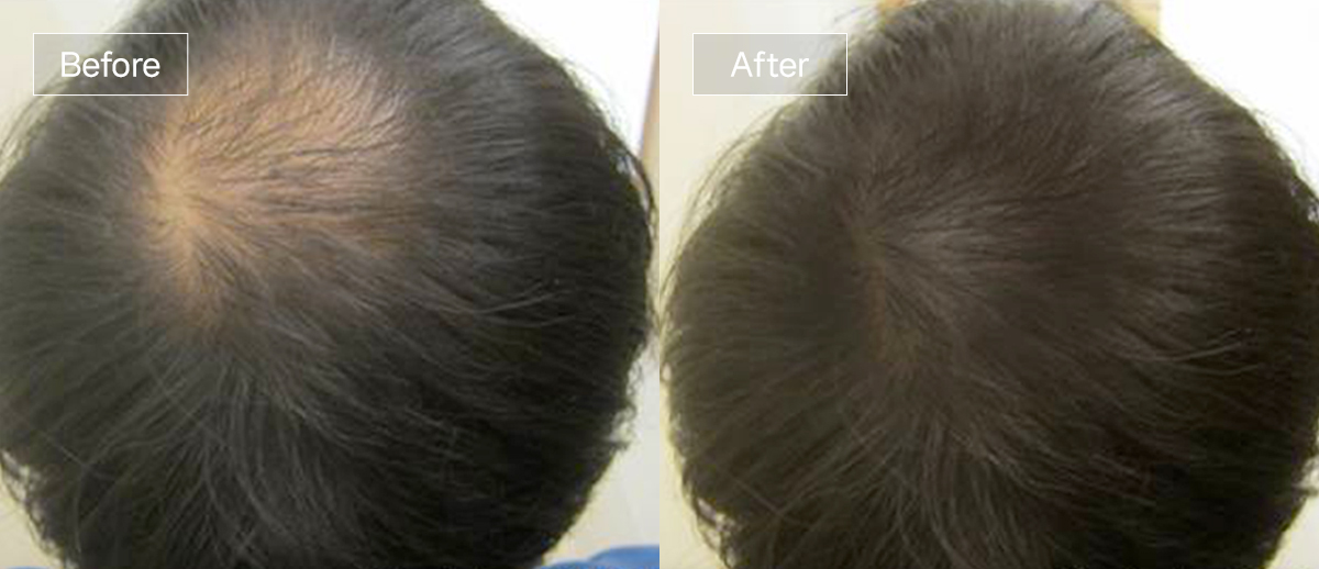 /filedata/md_board/20260102174724_P74FK5Cz_slide9.jpg 전후사진