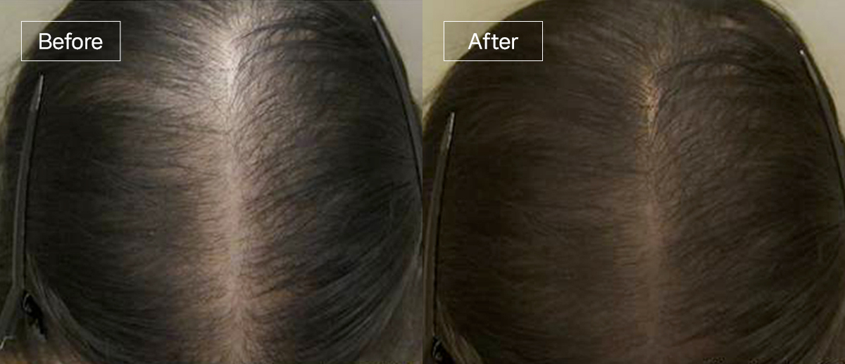 /filedata/md_board/20260102174904_QFvR582s_slide11.jpg 전후사진