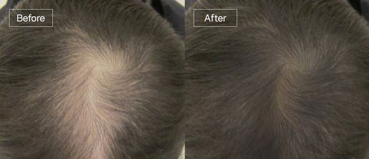 /filedata/md_board/20260102174918_r8alv1AN_slide12.jpg 전후사진