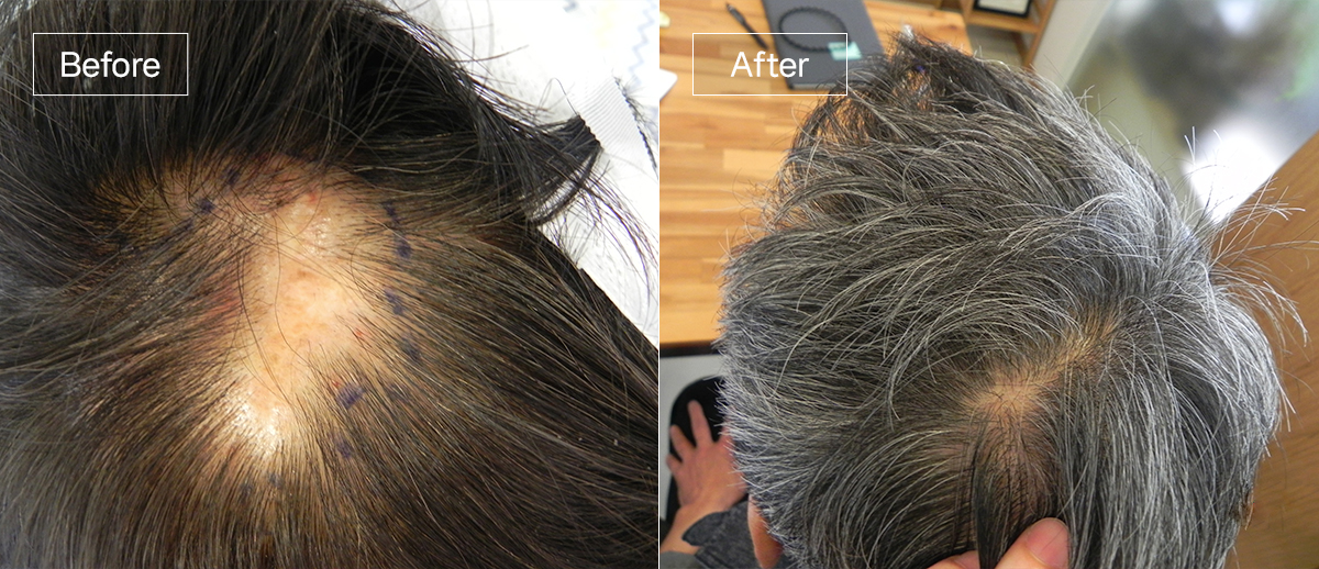 /filedata/md_board/20260102175104_GS9hjFqp_sub6_slide1.jpg 전후사진