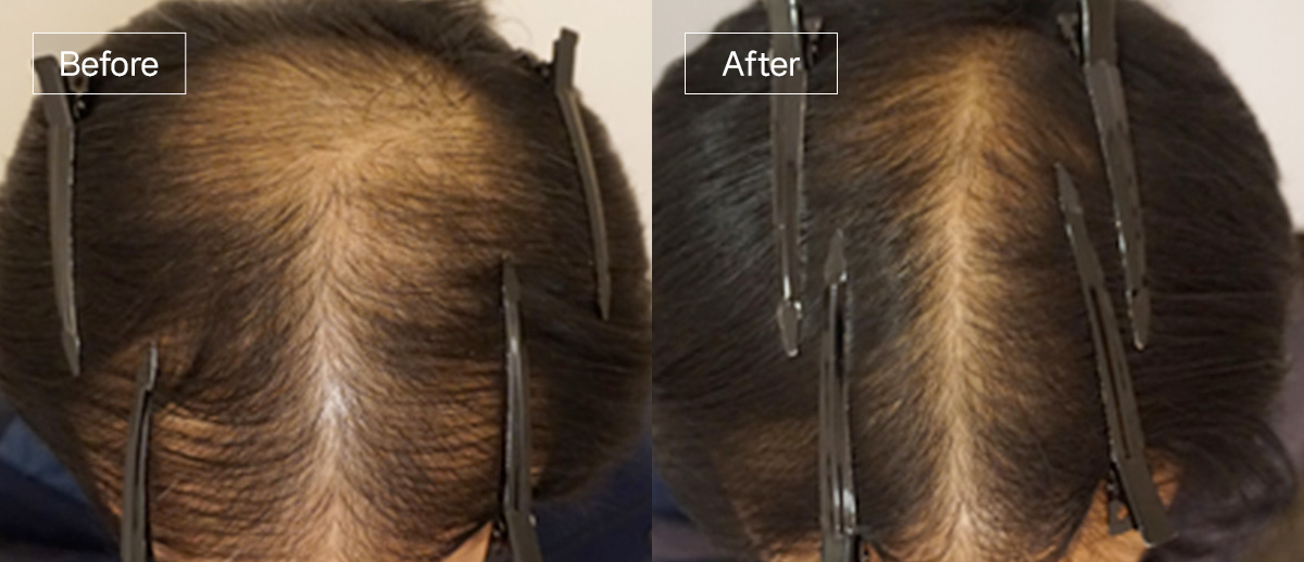 /filedata/md_board/20260102175133_fHxeZnvk_sub4_slide1.jpg 전후사진