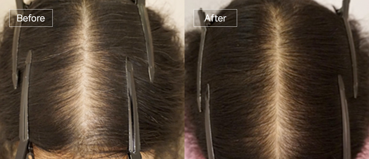 /filedata/md_board/20260102175144_RlJqj21k_sub4_slide3.jpg 전후사진