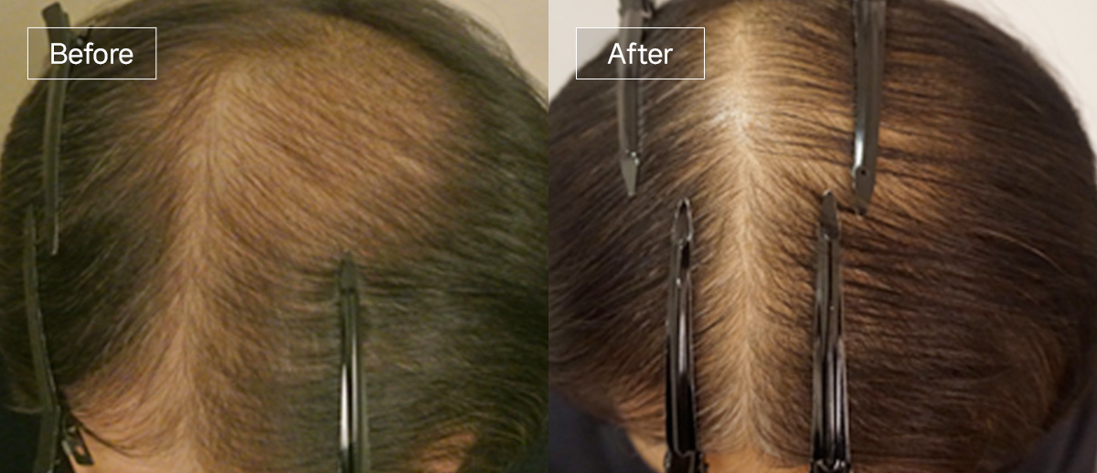 /filedata/md_board/20260102175207_OjB7sTJf_sub4_slide5.jpg 전후사진