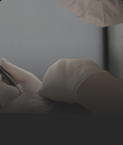 연세모벨르의원 SMP 두피문신