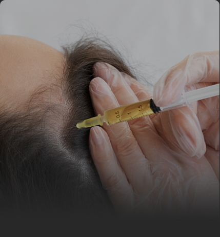 연세모벨르의원 탈모치료