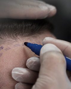 모발은 있어야 할 곳에 있어야 아름답습니다